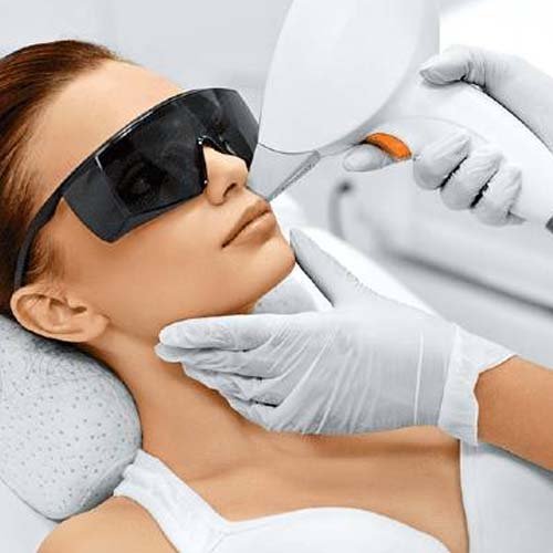 laser-hair-removal-omr